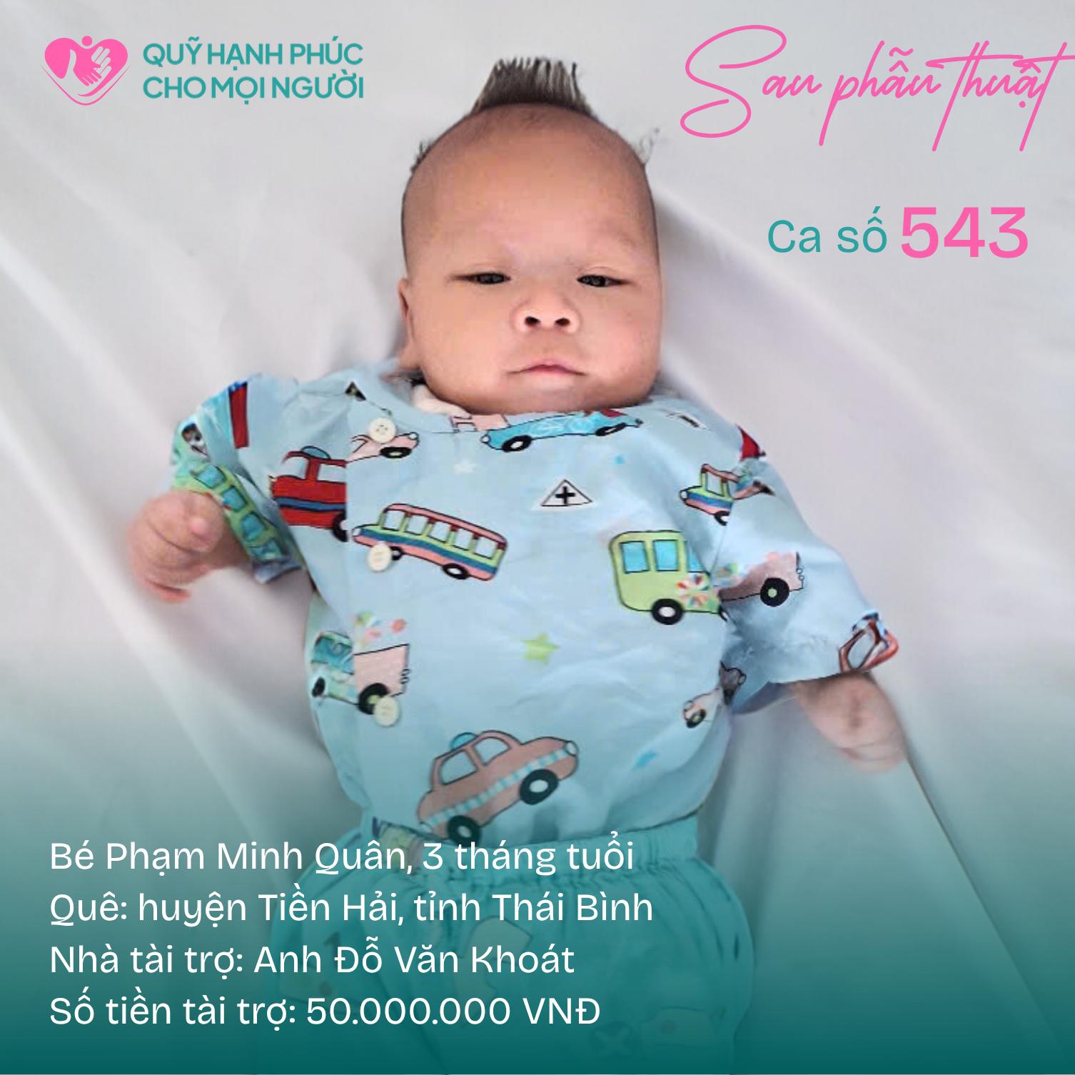 543-sau.jpg